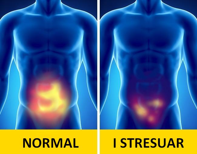 normal-stresuar