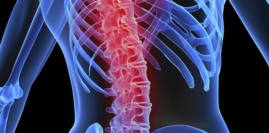 Ce este hemangiomul pe coloana vertebrală și cum să-l tratați