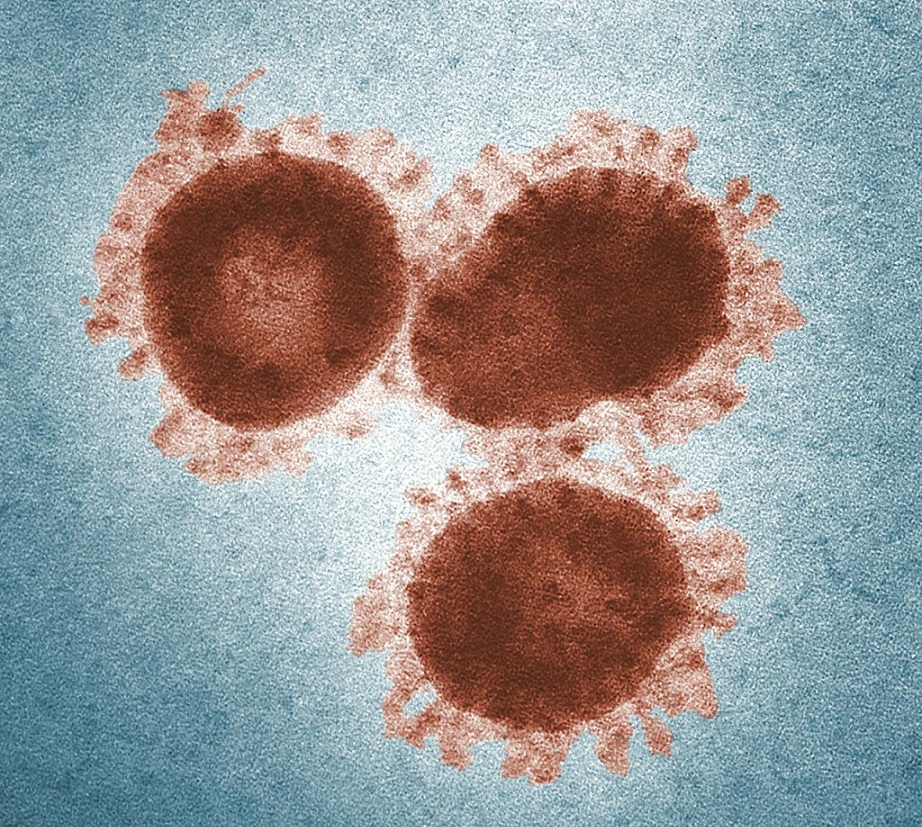virus-kovid