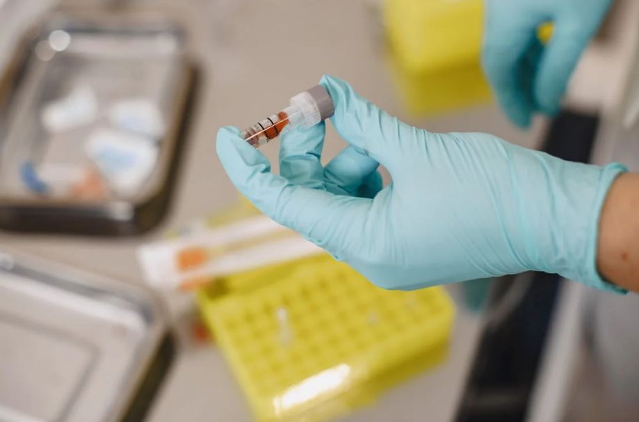 analiza-kolesterol-test