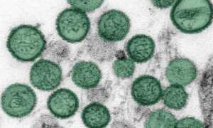 hantavirus