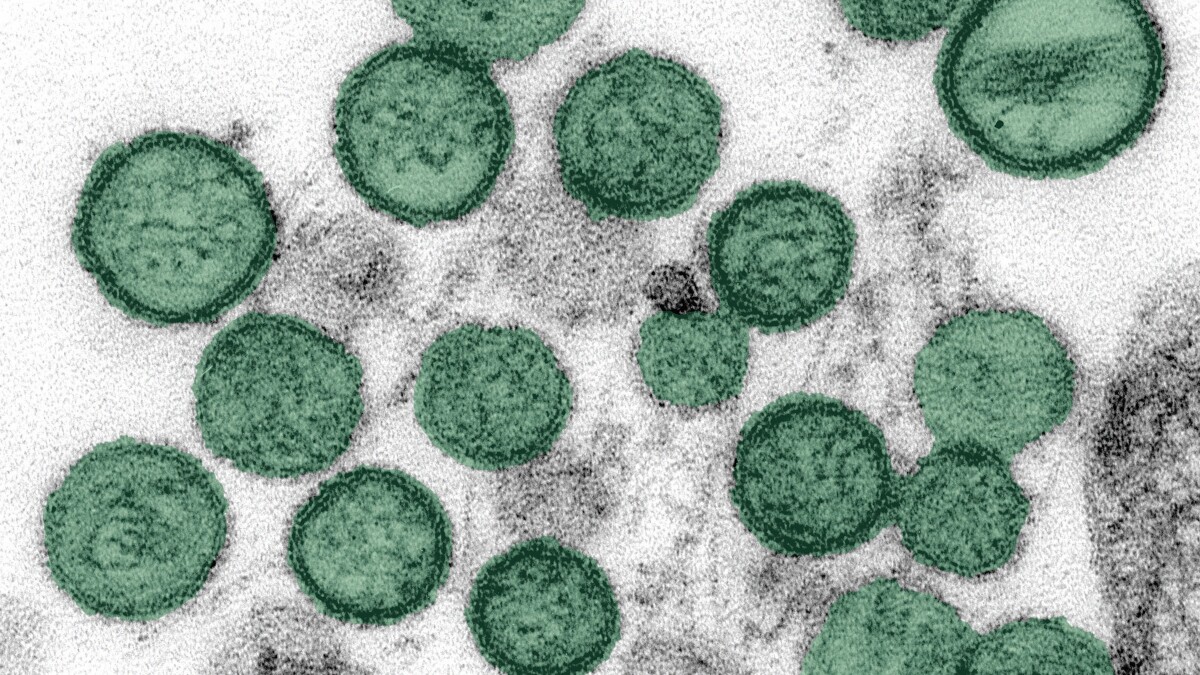 hantavirus